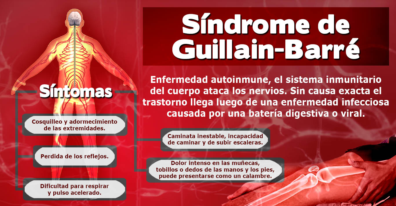 ALERTA EPIDEMIOLÓGICA EN EL PERÚ: SÍNDROME GUILLAIN-BARRÉ